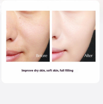 Buy Fade Black Acne Marks Cream Brightening And Removing Yellow Improve Whitening Cream online at DLC Market